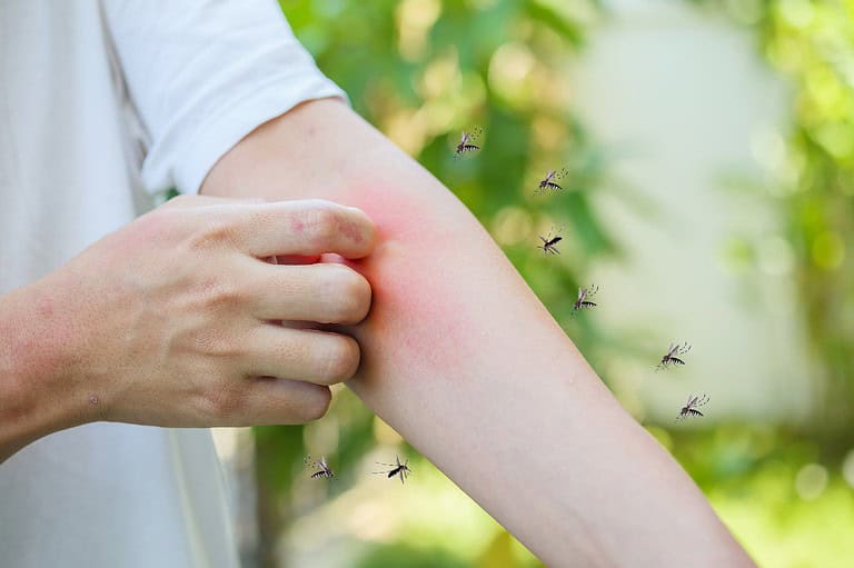 Man itching from mosquito bites. Discover the surprising colors that turn you into a mosquito magnet, according to groundbreaking new research!